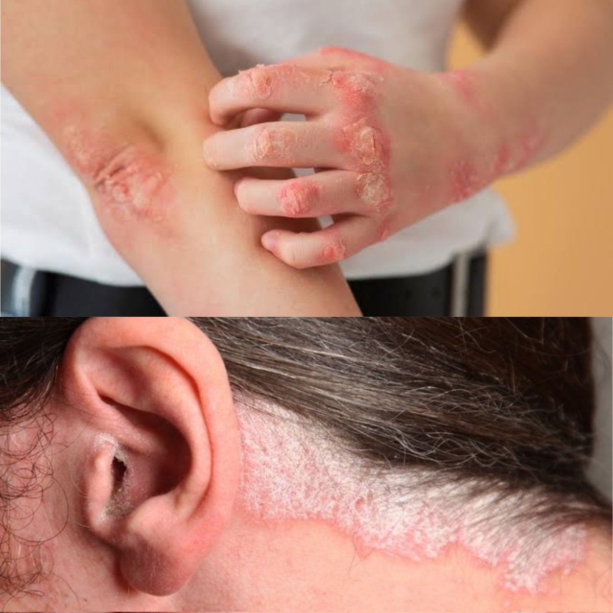 PatotaMJ's tweet image. •DISCRIMINAÇÃO E PRECONCEITO Entendendo melhor a 𝗣𝗦𝗢𝗥𝗜𝗔𝗦𝗘🤲🏼🩸:
- A Thread!🧶