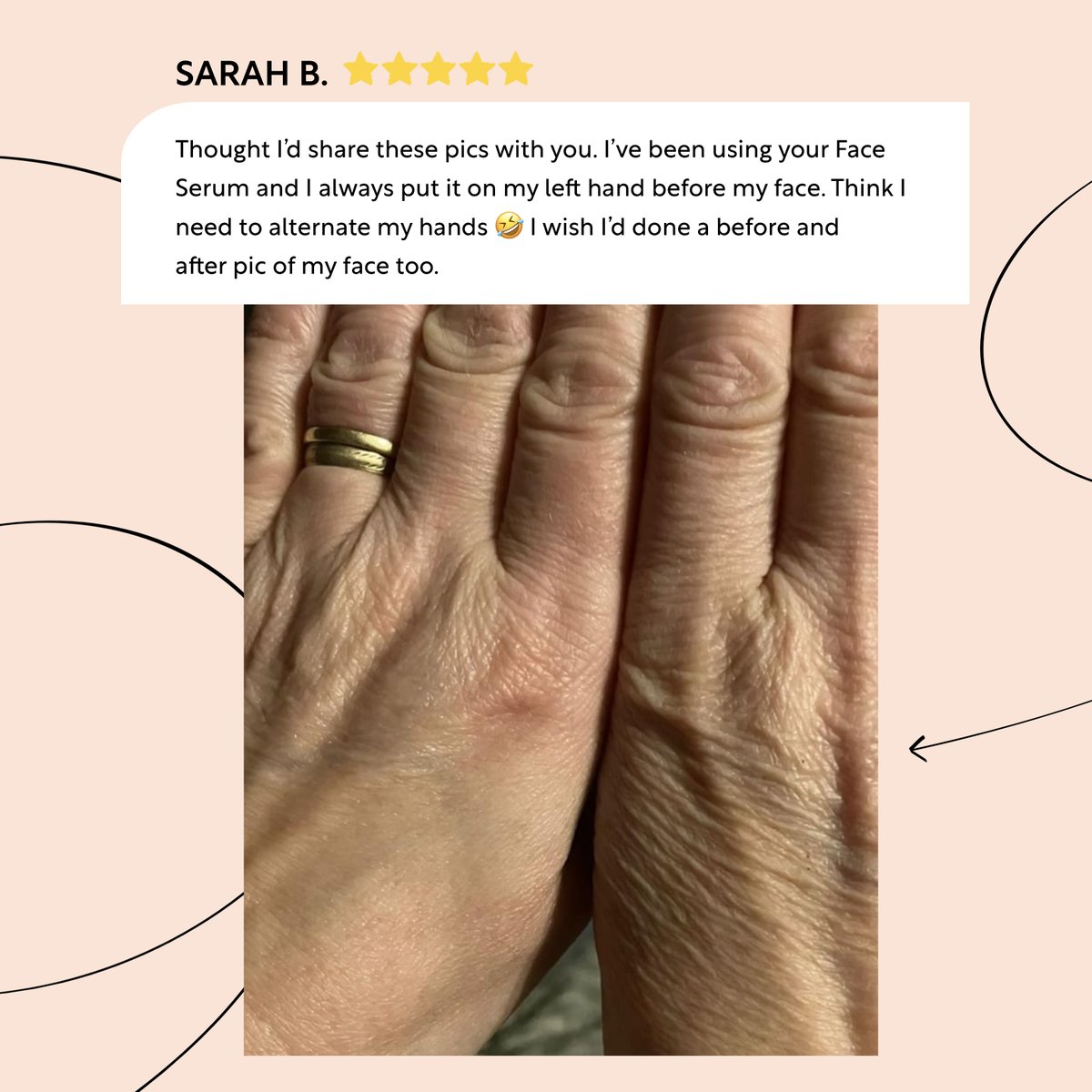 upcirclebeauty's tweet photo. When you accidentally transform the skin on just one hand by using it as a skincare prep palette! Wow!

Has anyone else experienced this before? 

#UpCircle #UpCirclebeauty #sustainability #skincare #skincareroutine #sustainable https://t.co/YlkzfdmyXf