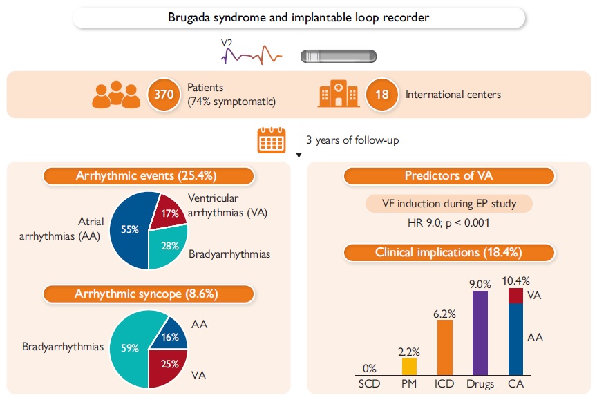 📢Brugada Syndrome and Syncope 🫀❗️ The BruLoop Study.. worth to read❗️ Now online from #EHJ @ESC_Journals 📚🆓👉doi.org/10.1093/eurhea… A great 🌍collaboration with @GiulioConte9 @enricobaldi88 @MBergonti @EuropaceEiC