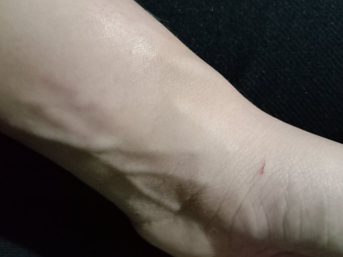 ทำงานได้ไรได้แผลทุกวันครับ.