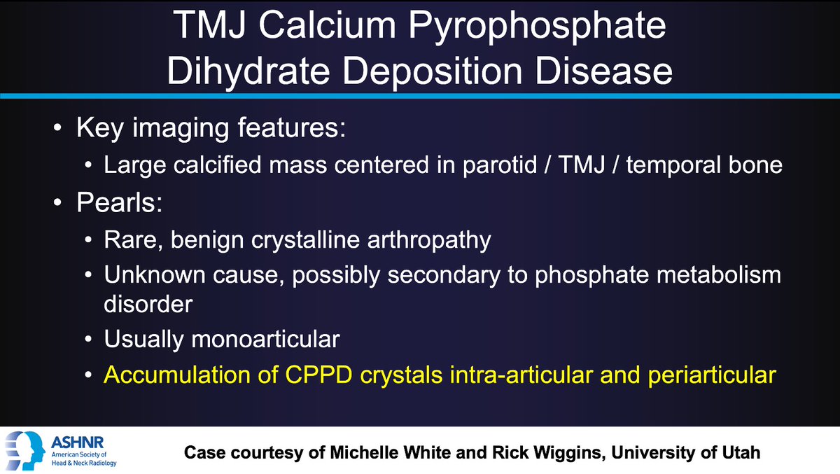 ASHNR (@ashnrsociety) on Twitter photo #ASHNRCOTW #244: ANSWER. Thx
<a href="/Michelle_JW18/">Michelle White</a> + <a href="/rhwiggins/">Richard Wiggins</a> 4 case! #ASHNR24
<a href="/callyrobs/">Caroline Robson, MBChB</a> <a href="/DShatzkes/">Deborah Shatzkes</a> <a href="/CDP_Rad/">C Douglas Phillips 🇺🇸</a> <a href="/nakoontz/">Nicholas Koontz</a> <a href="/KRileyMD/">Kalen Riley</a> <a href="/CMGlastonbury/">Christine M Glastonbury, MD</a> <a href="/cmtomblinson/">Courtney Tomblinson, MD</a> <a href="/tabby_kennedy/">Tabby A. Kennedy, MD</a> <a href="/PhilipRChapman1/">Philip R. Chapman, MD</a> @MohitAgNeurorad <a href="/AshokSrini15/">Ashok Srinivasan</a> <a href="/amyfjuliano/">Amy Juliano</a> <a href="/ENThawk/">Ashley Aiken</a> @LNLedbetter <a href="/KatieTraylorDO/">Katie S. Traylor MS, DO, DABR</a> #ASHNRCOTW #244: ANSWER. Thx
<a href="/Michelle_JW18/">Michelle White</a> + <a href="/rhwiggins/">Richard Wiggins</a> 4 case! #ASHNR24
<a href="/callyrobs/">Caroline Robson, MBChB</a> <a href="/DShatzkes/">Deborah Shatzkes</a> <a href="/CDP_Rad/">C Douglas Phillips 🇺🇸</a> <a href="/nakoontz/">Nicholas Koontz</a> <a href="/KRileyMD/">Kalen Riley</a> <a href="/CMGlastonbury/">Christine M Glastonbury, MD</a> <a href="/cmtomblinson/">Courtney Tomblinson, MD</a> <a href="/tabby_kennedy/">Tabby A. Kennedy, MD</a> <a href="/PhilipRChapman1/">Philip R. Chapman, MD</a> @MohitAgNeurorad <a href="/AshokSrini15/">Ashok Srinivasan</a> <a href="/amyfjuliano/">Amy Juliano</a> <a href="/ENThawk/">Ashley Aiken</a> @LNLedbetter <a href="/KatieTraylorDO/">Katie S. Traylor MS, DO, DABR</a>