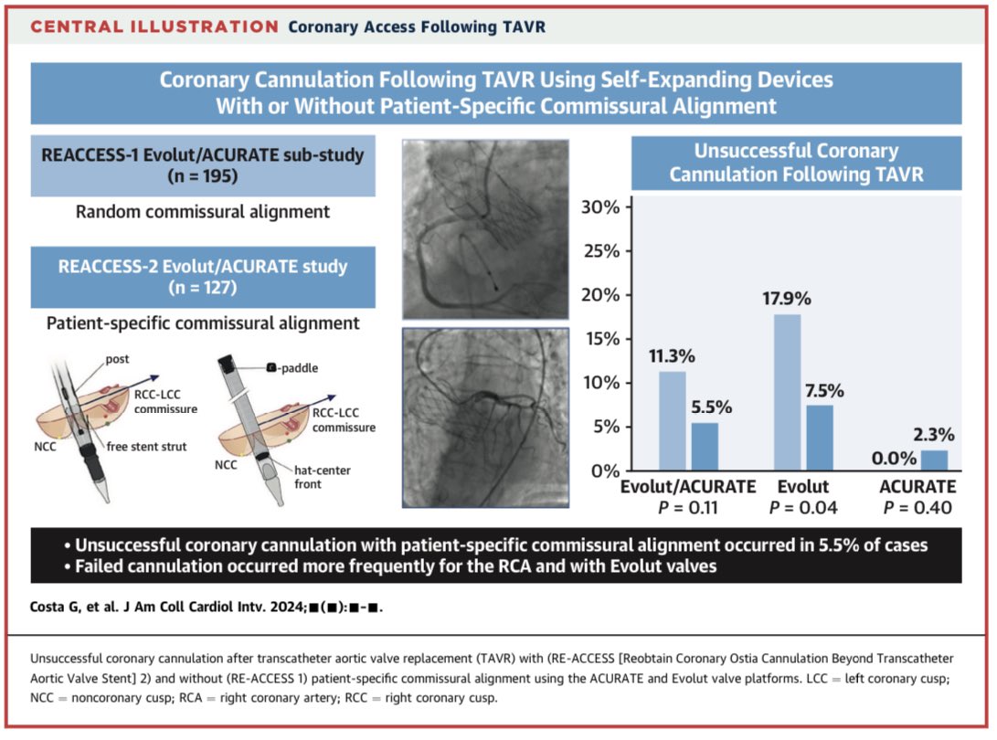 In the RE-ACCESS 2 Study unsuccessful coronary cannulation after #Evolut and #Acurate implanted with commissural alignment was 5.5%. Acurate still better than Evolut, but Remarkable improvement compared with RE-ACCESS.Commissural alignment in #TAVI matters @JACCJournals