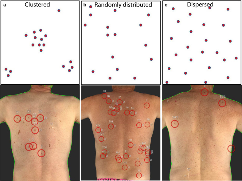 'Does the Skin Molecular Ecosystem Hold the Key to Nevogenesis and Melanomagenesis?' a perspective by Katie Lee, Peter Soyer, & Mitchell Stark doi.org/10.1016/j.jid.… #JIDJournal #dermscience #dermtwitter @anotherkatielee @thestarklab @hpsoyer @UQDRC