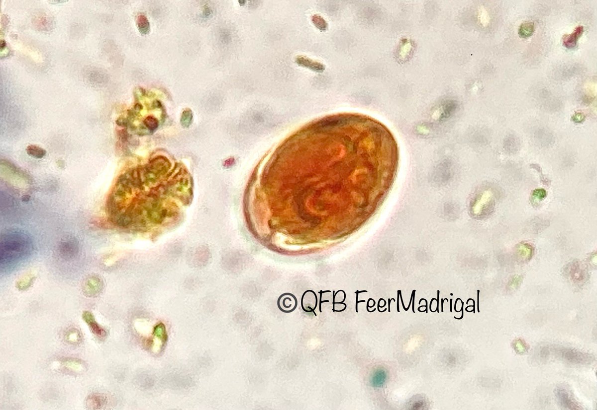 FeerMadrigalM's tweet photo. Quistes de Giardia lamblia (Giardia duodenalis, Giardia intestinalis) 🔬
Muestra con solución salina y tincion con Yodo-Lugol ✨
#parasitologia #parasitos #qfb #ciencia #laboratorio #clinico #microscopy #microscopio #parasitology https://t.co/MSt2HNcy0Q