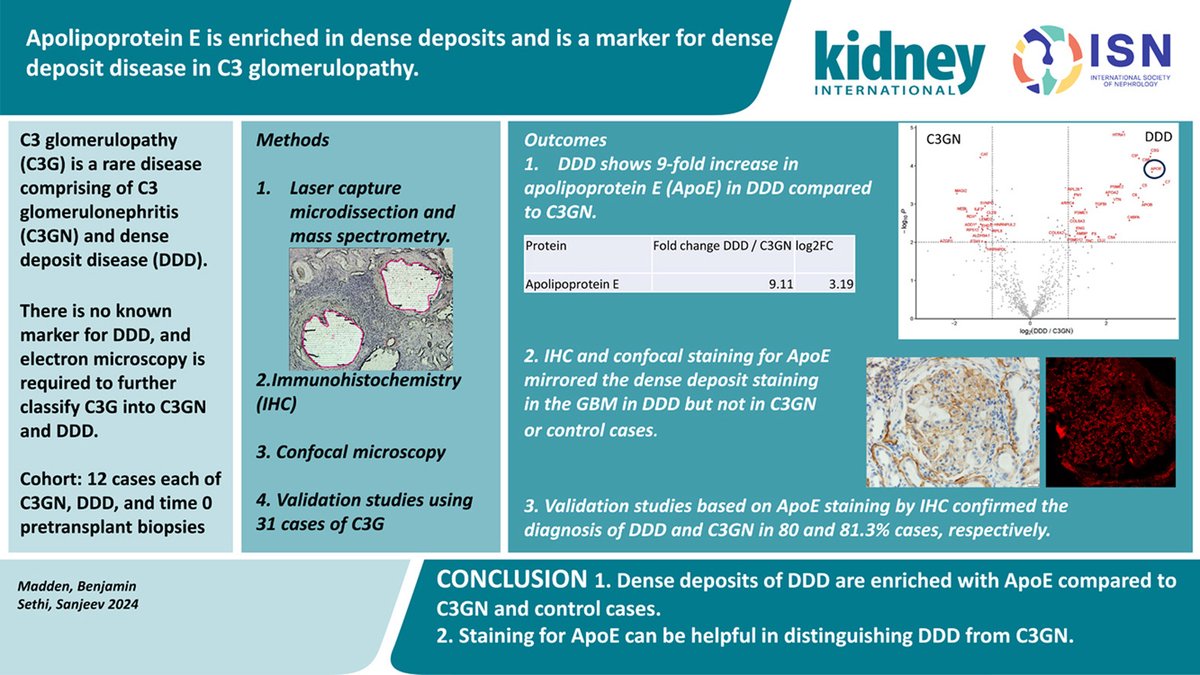 Kidney_Int's tweet photo. #ApolipoproteinE is enriched in dense deposits and is a marker for #densedepositdisease in #C3glomerulopathy

https://t.co/P2CW9x3uXC

@MayoClinicPath @MayoClinicNeph @CedarsSinaiMed @unicampoficial @lalpathlabs
#OpenAccess #Complement #kidneydisease https://t.co/6bPEtHx6Ye