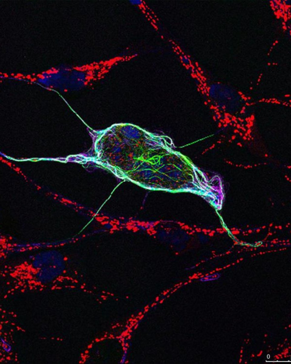 Mitochondria are small structures within our cells that generate most of the chemical energy needed to power the cell's biochemical reactions. @RossanaSapiro is #ImagingTheFuture by using multiple imaging tools to learn more about their role in health and disease