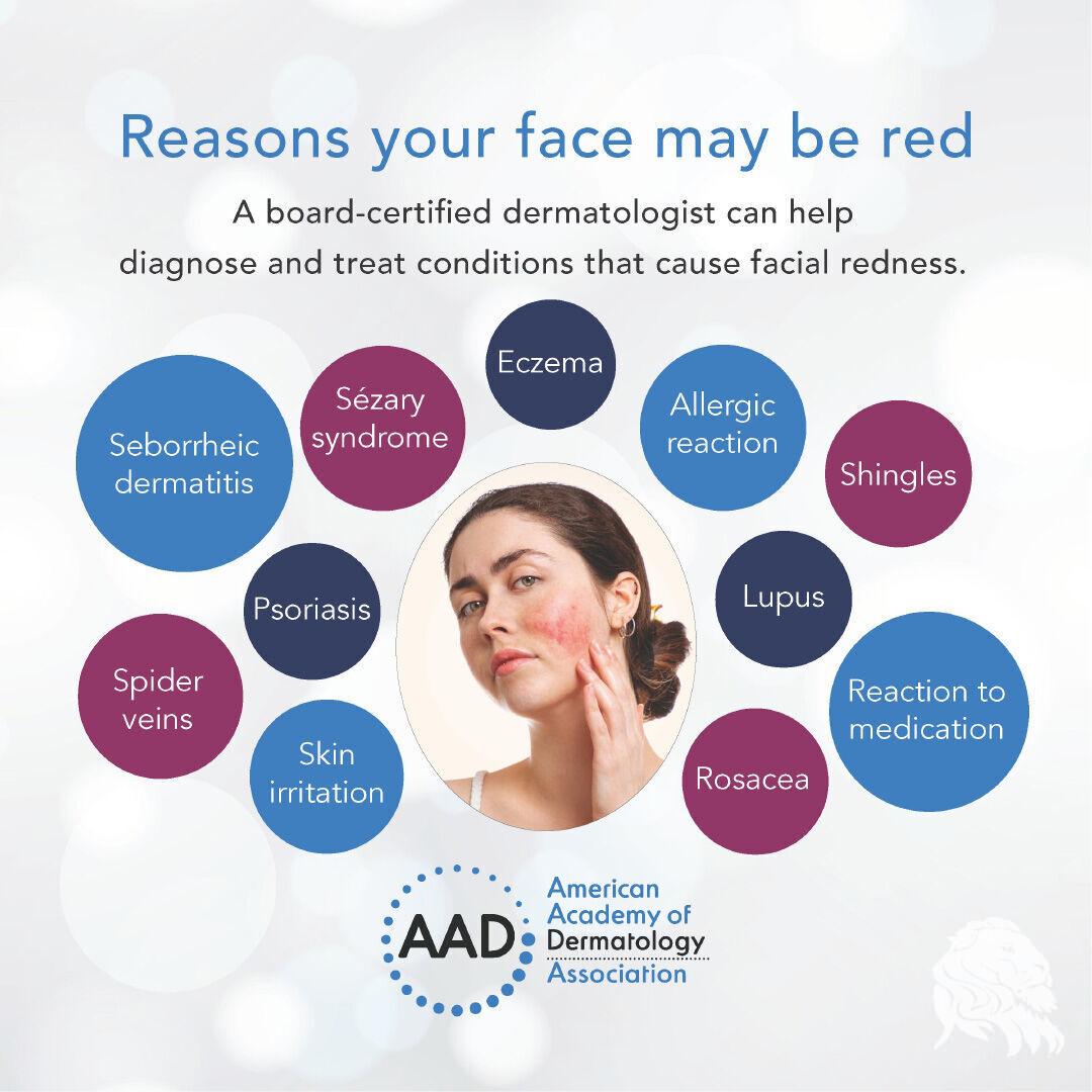 AssocinDerm's tweet image. Acne and sunburn cause redness, but there could be another reason your face is red. Here are 10 less obvious reasons for a red face... 

#healthyskin #associnderm #redness