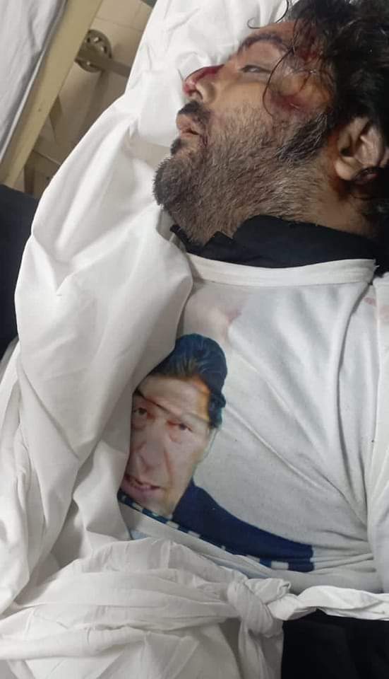 AmirSalar_Wazir's tweet photo. اج زلے شاہ کی برسی ہے میرے یار کی شہید ہونے کا ایک سال پورا ہوگیا لیکن افسوس اس کے قاتل کو ابھی تک سزا تو دور کی بات بلکہ گرفتار تک نہیں کئے 😭😭
عامر خان سالار https://t.co/x1Y8QhGoFv