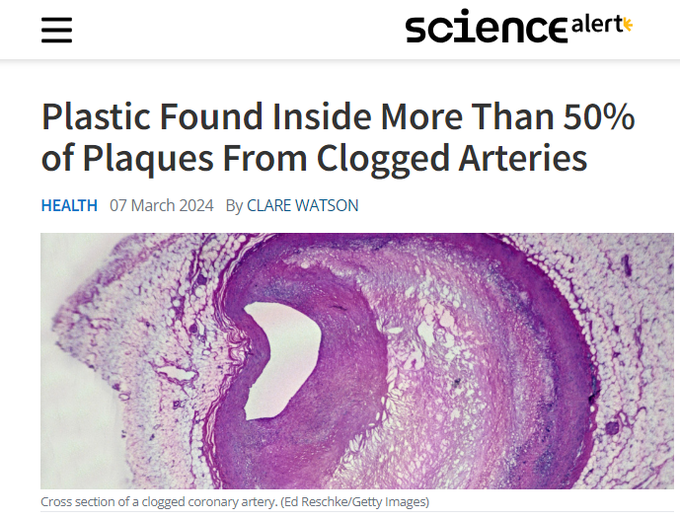 Science alert headline: Plastic found inside more than 50% of plaques from clogged arteries