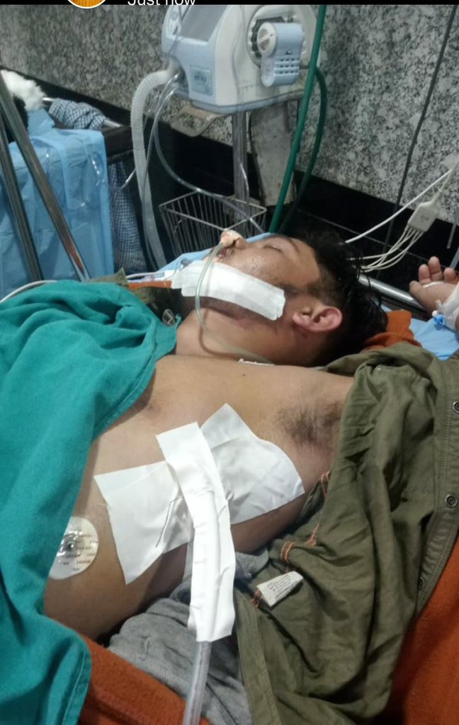 RahiGagan1's tweet photo. @myogiadityanath जी विनम्र निवेदन मामले को गंभीरता से लेते हुए  BHU Trauma Centre में उचित इलाज कराया जाए। मरीज मनीष कुमार का बुरा हालत होने के बावजूद भी उसे जेनरल वार्ड में रखा गया है।उम्मीद करता हूं उचित करवाई करके इस मामले को संज्ञान में लेंगे। @UPGovt @PMOIndia @MoHFW_INDIA https://t.co/ZehNrKaNOD