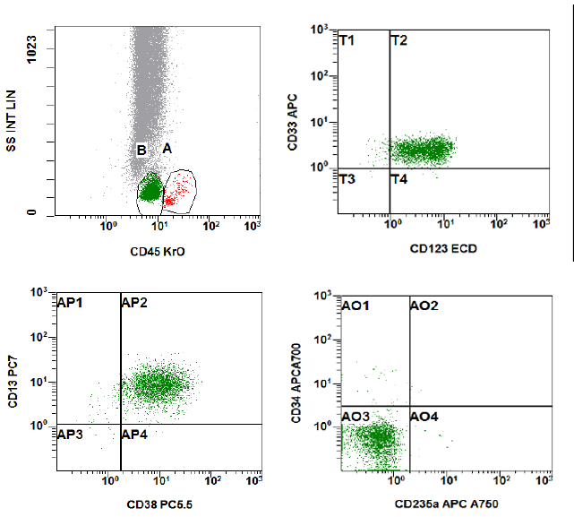 As many of you guessed, these cells are indeed basophils! 
Basophils are seen in the "blast" gate, have low side scatter, and express dim CD45, CD13, CD33, CD38 and CD123. Unlike plasmacytoid dendritic cells, basophils do not express HLA-DR. 
For more see: cytometry.org/web/q_view.php…