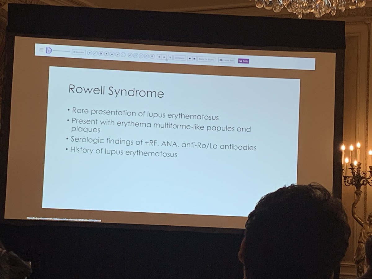 anumdilip's tweet image. Rowell syndrome rare presentation of SLE #isdp day 2