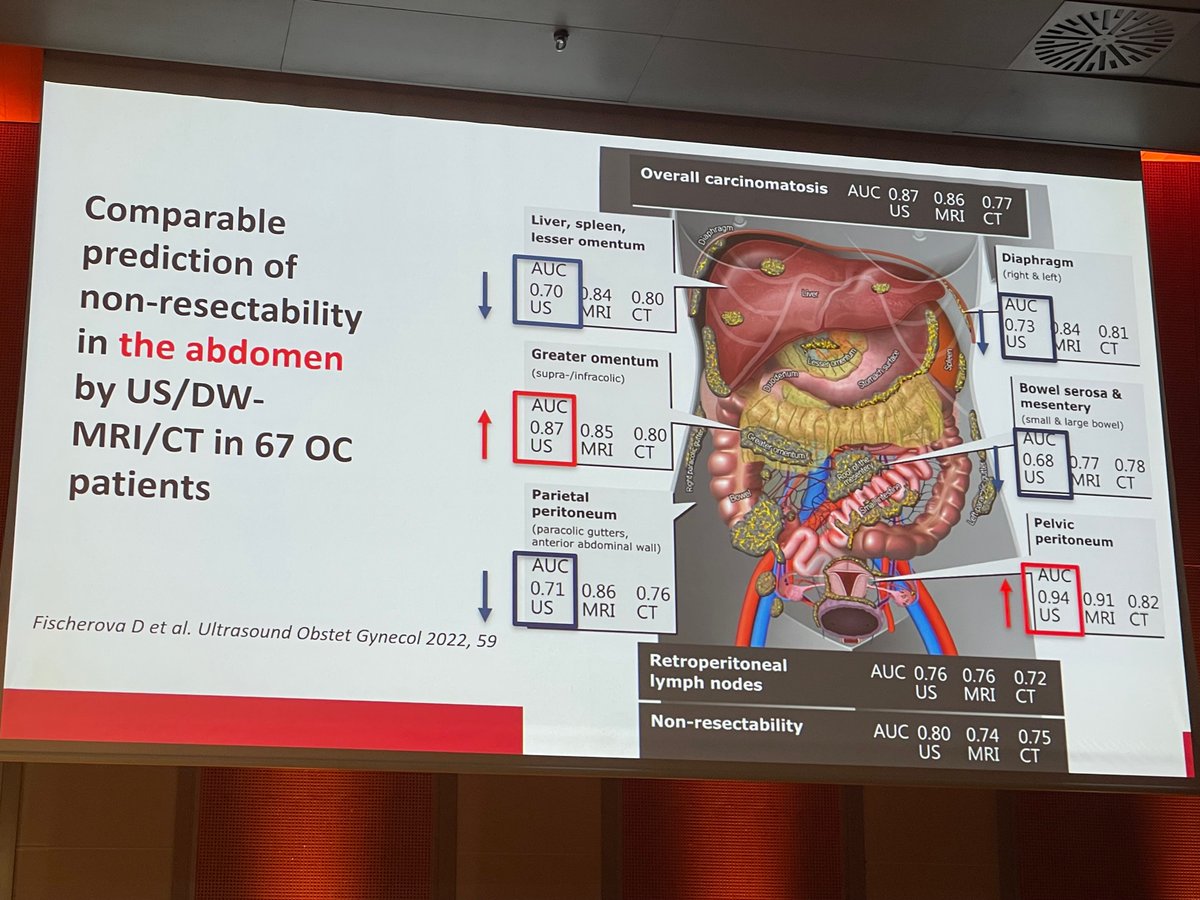Enlightening debate on leveraging imaging tools for TRS in OC. 🌟 Dr. <a href="/IngfridHaldors1/">Ingfrid Haldorsen</a> unveiled insights on diverse modalities. See the 'trouble maker' areas in the pic. 📸 From CT CAP w/C is first line. But don't underestimate expert ultrasound. <a href="/ESGO_society/">ESGO</a> #ESGO2024