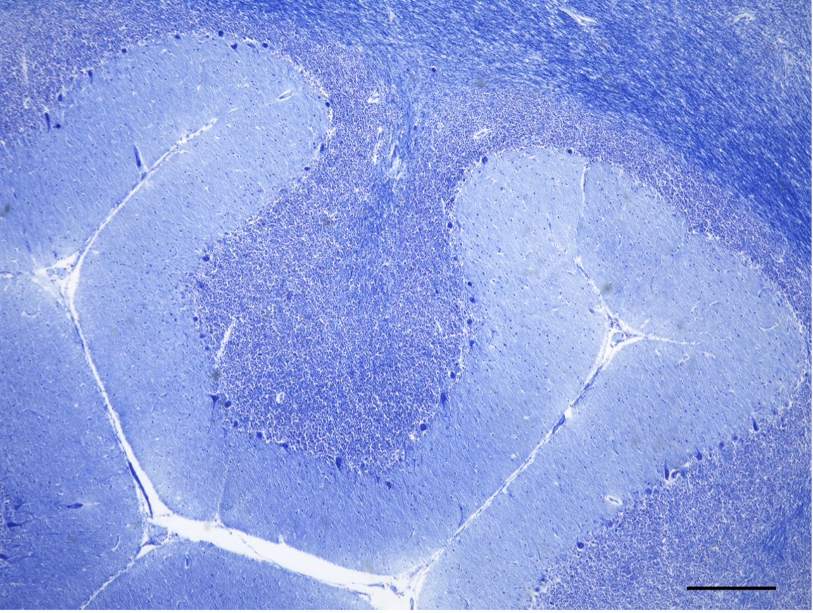 🔬Exploring the intricate human cerebellum under the microscope! 🧠This histological technique, Klüver-Barrera staining, reveals the beauty of neural tissue by highlighting key structures and cellular elements. 
#pictureoftheweek #histology #neuroscience 

Image by: <a href="/SoAu0108/">Sophia A.</a>