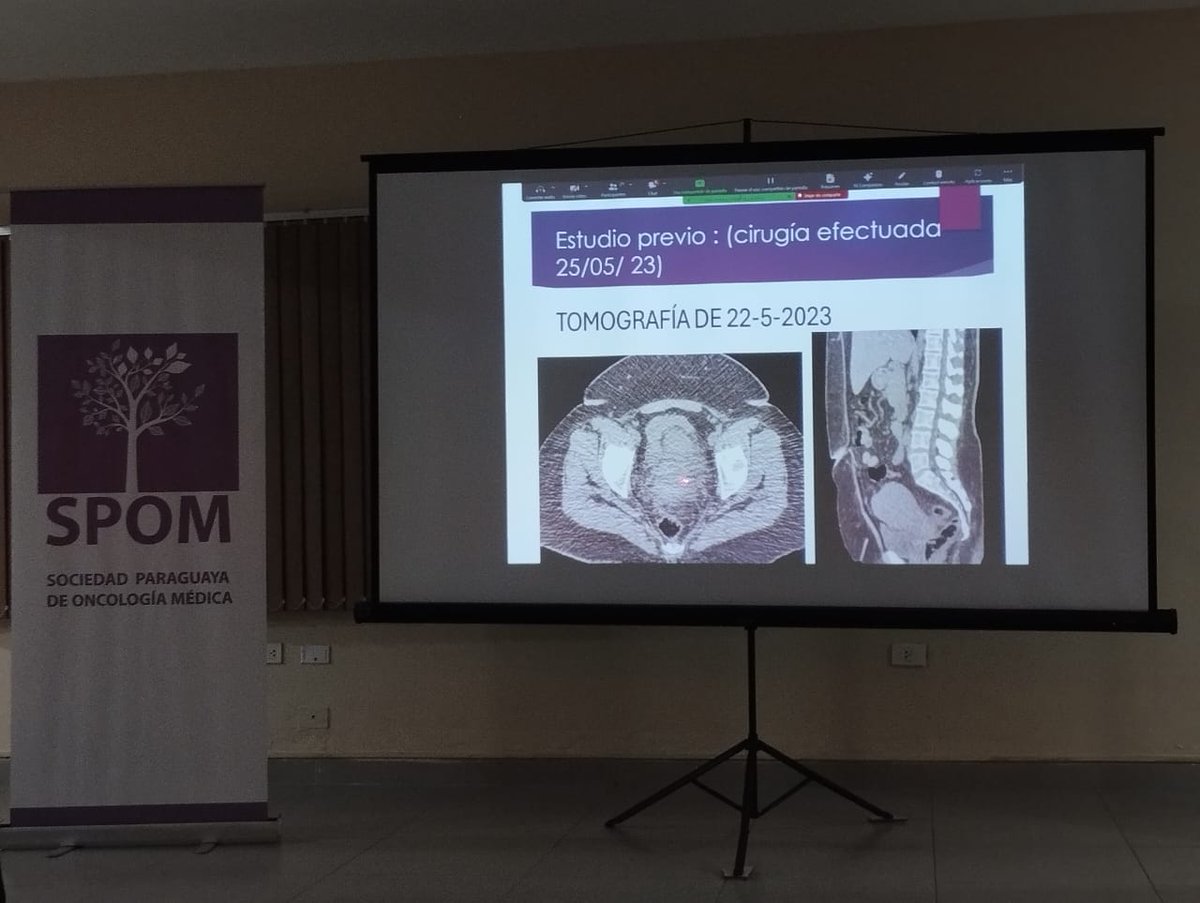 MARZO

Mes de concientización sobre cáncer de cuello uterino. 

Reunión intersociedades. 07.03.24