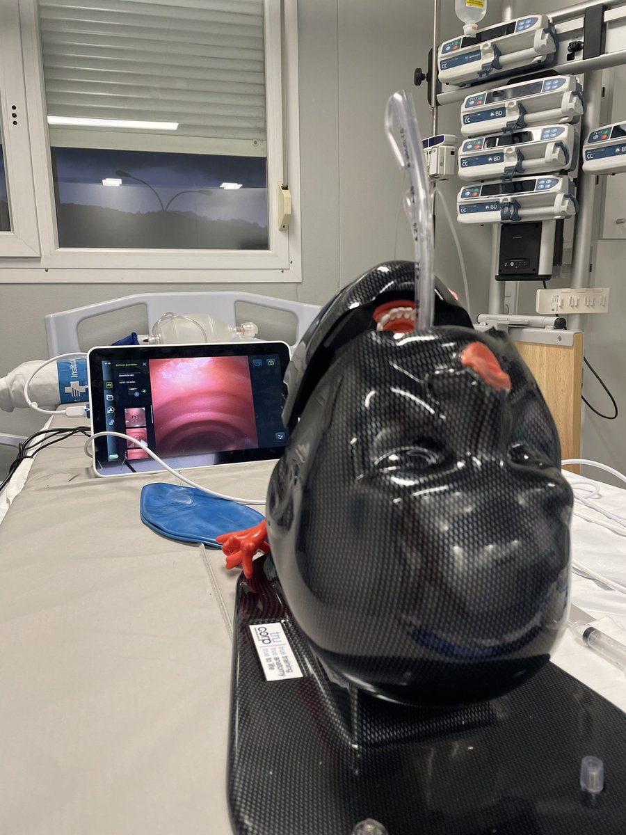 BroncoscopiaUCI's tweet photo. Hemos tenido la oportunidad de usar en el BadaFibro 2024 @hgermanstrias, el tubo endotraqueal VivaSight 2 SLT, tiene una cámara de vídeo integrada.
-Permite la visualización continua de la posición del tubo y del bloqueador endobronquial. @AmbuEurope @SOCMIC https://t.co/dgdQZN0v7y