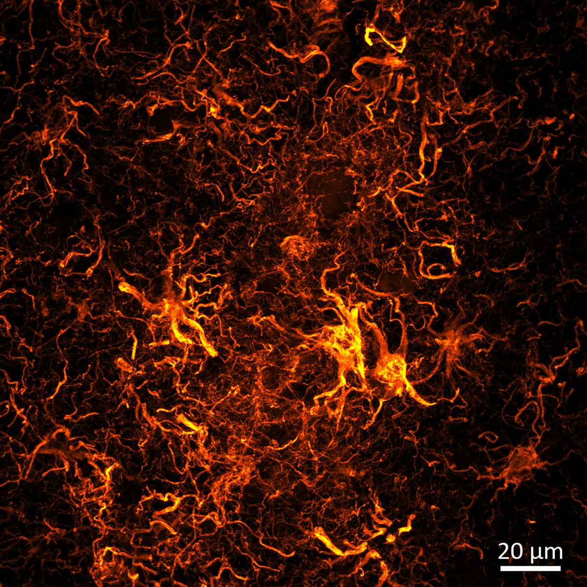One marker, many different images! Glial fibrillary acidic protein (GFAP), a standard marker for astrocytes, easily shows how diverse and multifunctional these cells are! My favorite are the ones showing their association with surrounding blood vessels, and you? 😍🧠🔬