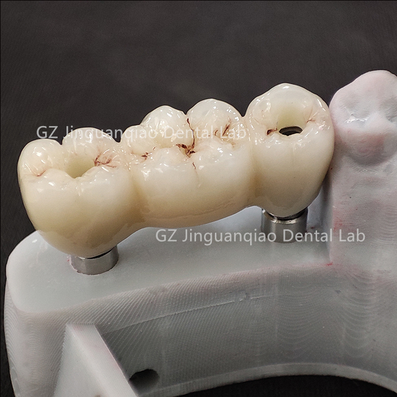 ZhaoJason57098's tweet photo. Guangzhou JGQ Dental Lab--Implant center 

#dentalclinic #dentallab #dentures #dentistry

https://t.co/hyn9we4NNc https://t.co/lorJBsqmW6