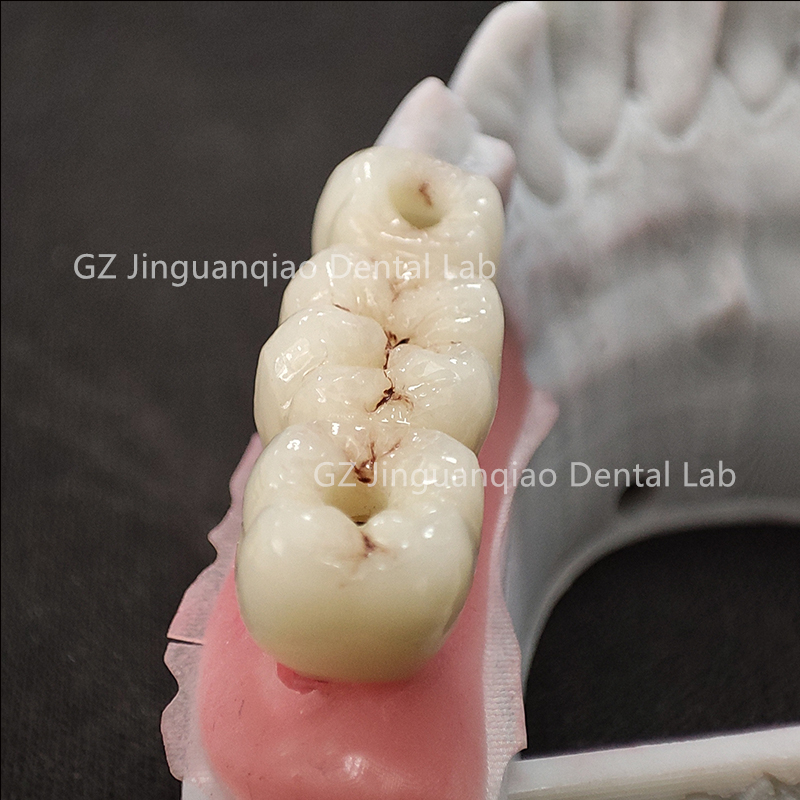 ZhaoJason57098's tweet photo. Guangzhou JGQ Dental Lab--Implant center 

#dentalclinic #dentallab #dentures #dentistry

https://t.co/hyn9we4NNc https://t.co/lorJBsqmW6