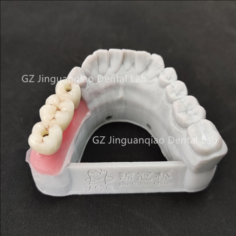 ZhaoJason57098's tweet photo. Guangzhou JGQ Dental Lab--Implant center 

#dentalclinic #dentallab #dentures #dentistry

https://t.co/hyn9we4NNc https://t.co/lorJBsqmW6