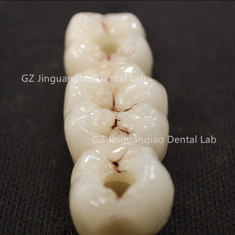 ZhaoJason57098's tweet photo. Guangzhou JGQ Dental Lab--Implant center 

#dentalclinic #dentallab #dentures #dentistry

https://t.co/hyn9we4NNc https://t.co/lorJBsqmW6