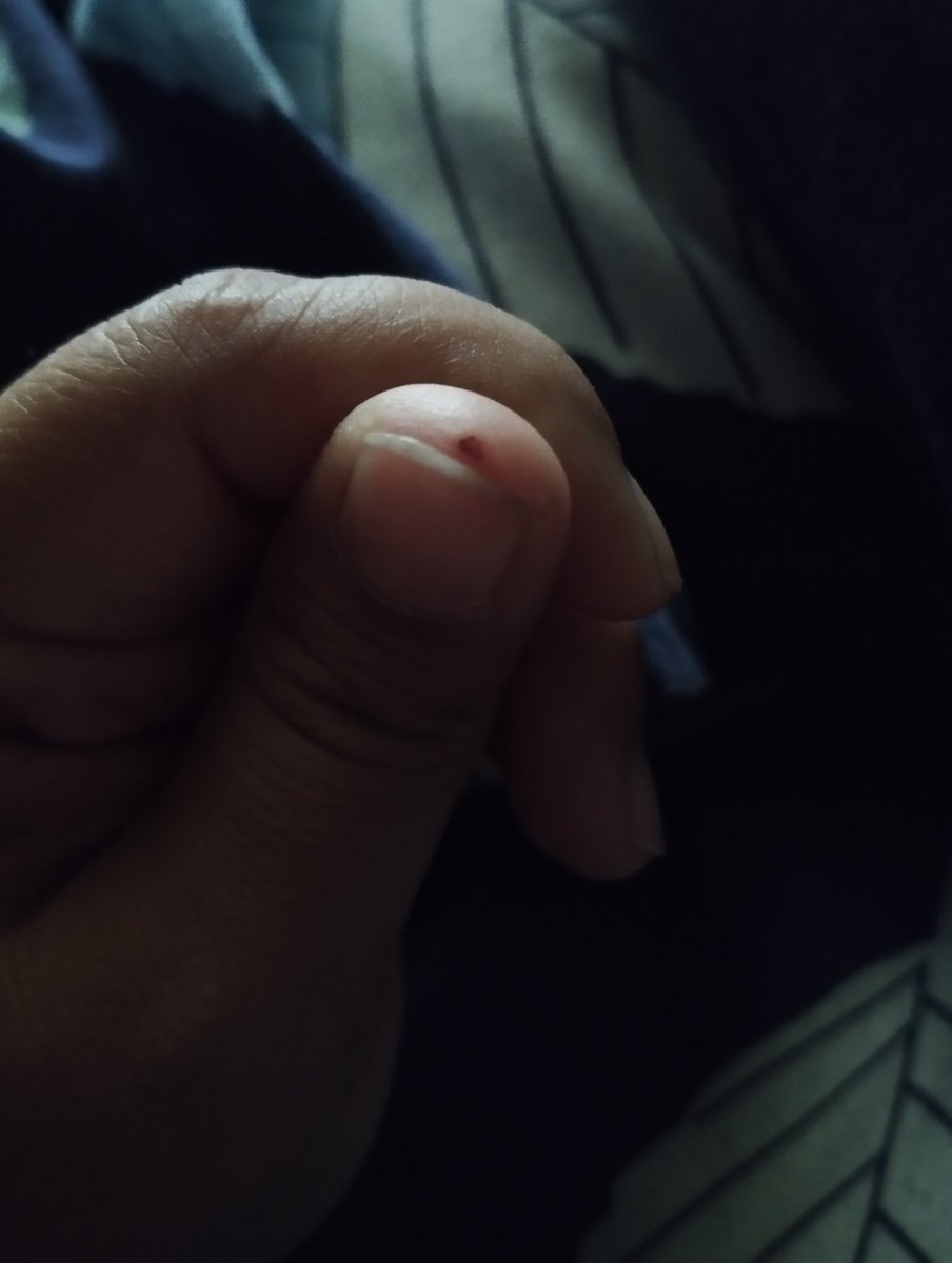 VietaDevi's tweet photo. bener2 cuil kaya di potong pakai pemotong kuku.. https://t.co/5u3XVZSMub