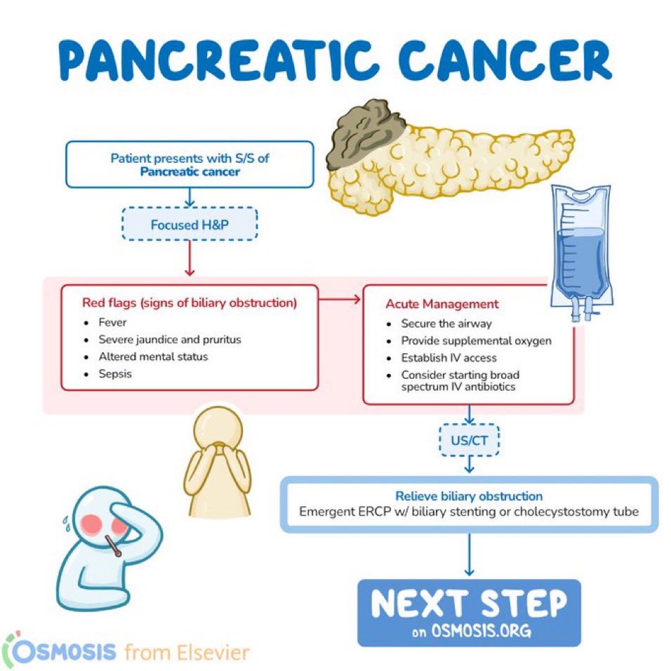 Pancreatic adenocarcinomas are exocrine tumors and are most often located in the head of the pancreas

<a href="/OsmosisMed/">Osmosis from Elsevier</a> #MedEd #MedX
