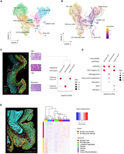 brukerspatial's tweet image. The Singapore Gastric Cancer Consortium analyzed 1,256 #gastric samples across 692 subjects in a prospective 10-year study 👉bit.ly/47OzwYk
This #Fridayread published in Cancer Cell shows how GeoMx DSP was used to perform #spatiotemporal genomic profiling of this cohort.
