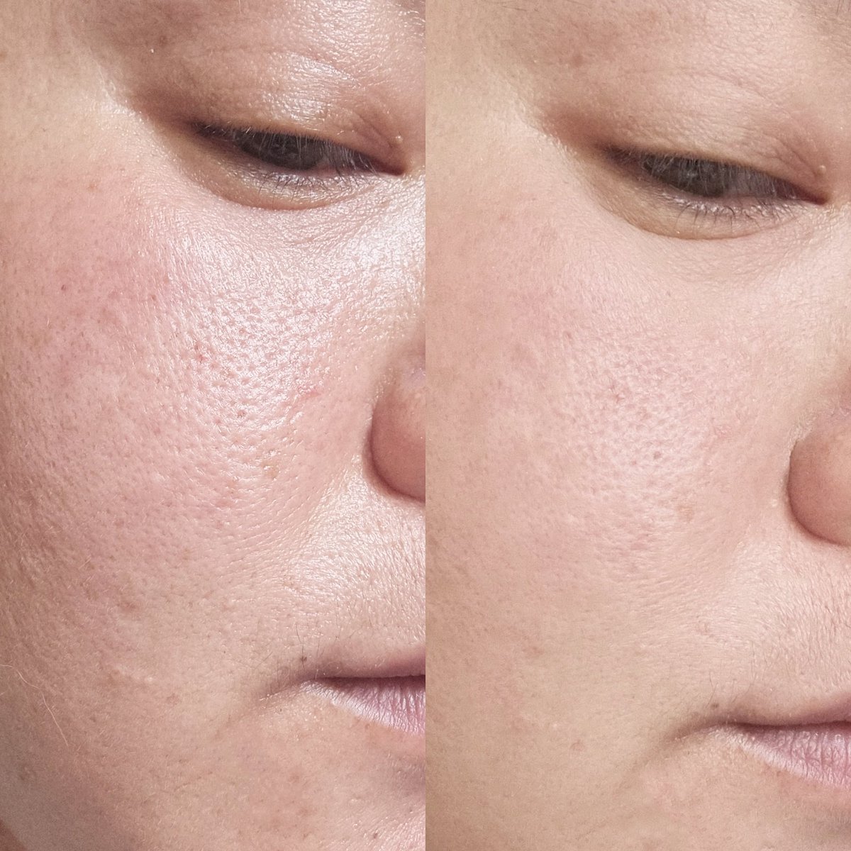 รีวิวอีกรอบย้ำความปัง แป้งฝุ่นที่ใช้ตลอดมาและจะใช้ตลอดไปจะเป็นตัวไหนไปไม่ได้ #แป้งม่วงในตำนาน #แป้งม่วงศรีจันทร์ ตัวนี้ยืนหนึ่งเรื่องคุมมัน เบลอผิวสวยกริบ เนื้อแป้งเค้าละเอียดมากกกกก แล้วต่อให้อากาศเมืองไทยจะกี่องศา หน้าก็ไม่ไหล แถมยังช่วยปกป้องผิวจากฝุ่น PM2.5 ด้วย