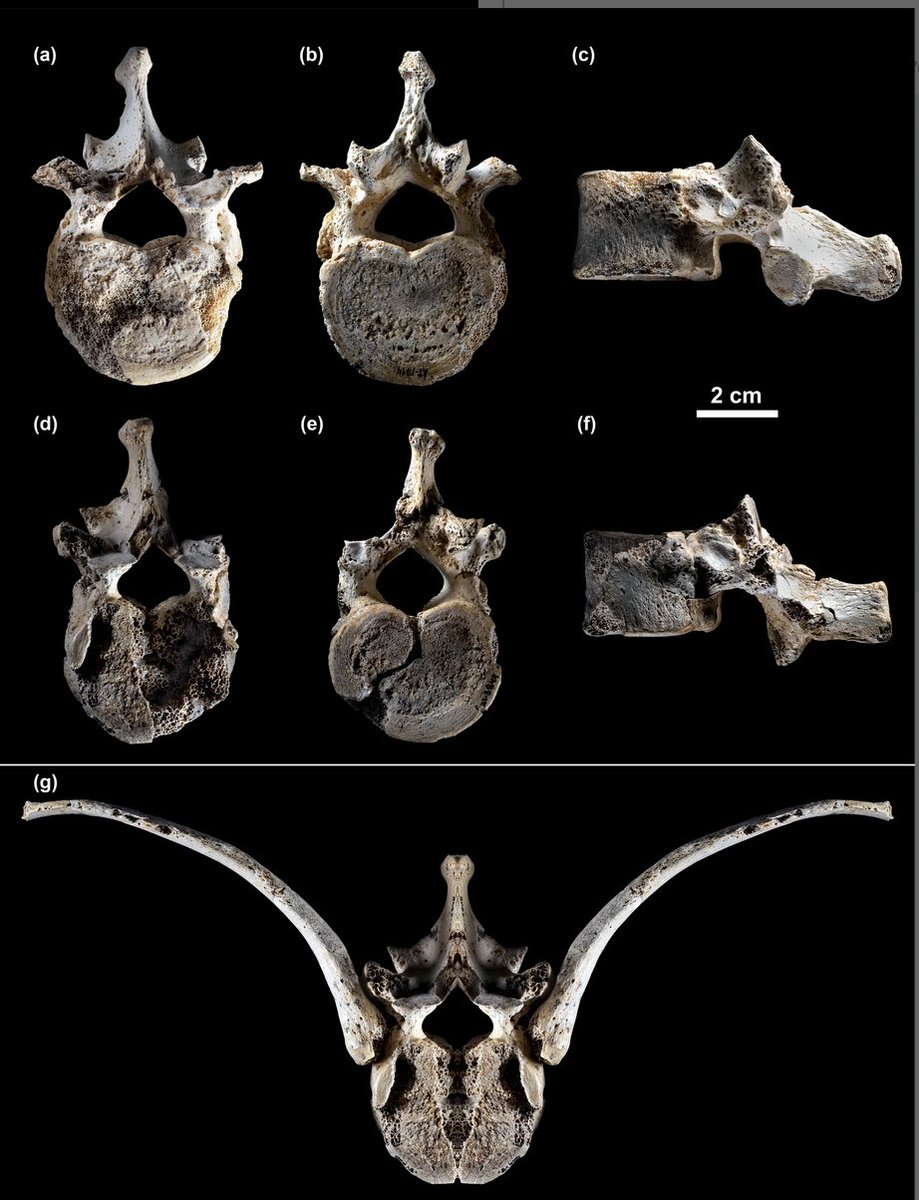 Asier Gómez Olivencia (@asiergolivencia) on Twitter photo New article out!
The Sima de los Huesos thorax and lumbar spine: Selected traits and state‐of‐the‐art - Gómez‐Olivencia & Arsuaga - The Anatomical Record anatomypubs.onlinelibrary.wiley.com/doi/10.1002/ar…
#FossilFriday
<a href="/JuanLuisArsuaga/">Juan Luis Arsuaga</a>
<a href="/ehugeologia/">Geologia UPV/EHU</a>
<a href="/FATAPUERCA/">FUNDACION ATAPUERCA</a> New article out!
The Sima de los Huesos thorax and lumbar spine: Selected traits and state‐of‐the‐art - Gómez‐Olivencia & Arsuaga - The Anatomical Record anatomypubs.onlinelibrary.wiley.com/doi/10.1002/ar…
#FossilFriday
<a href="/JuanLuisArsuaga/">Juan Luis Arsuaga</a>
<a href="/ehugeologia/">Geologia UPV/EHU</a>
<a href="/FATAPUERCA/">FUNDACION ATAPUERCA</a>