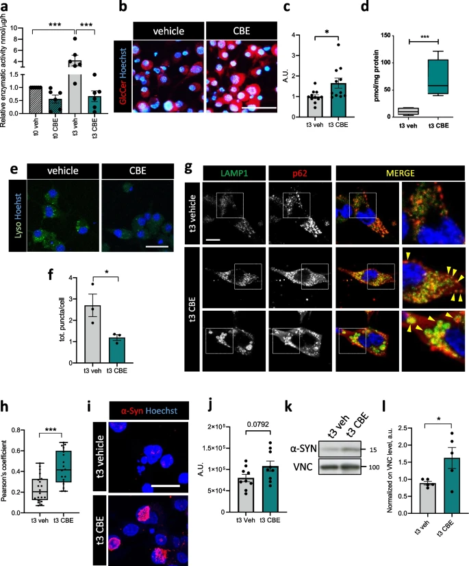 'GBA1 inactivation in #oligodendrocytes affects #myelination and induces #neurodegenerative hallmarks and lipid dyshomeostasis in mice' Ilaria Gregorio @LorisRusso15...Matilde Cescon @UniPadova #Parkinsons bit.ly/4a29FxA