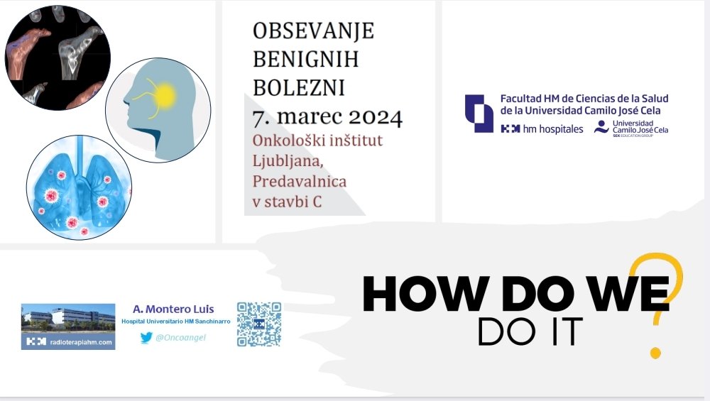 Angel Montero Luis (@monthy_a) on Twitter photo A terrific honor to be at Institute of Oncology Ljubljana sharing with colleagues and friends our experience at <a href="/RadioterapiaHM/">RadioterapiaHM</a> in the use of radiotherapy in non-tumor diseases. Thanks a lot to <a href="/i_ratosa/">Ivica Ratosa</a> for invitation!! #ldrt #radonc A terrific honor to be at Institute of Oncology Ljubljana sharing with colleagues and friends our experience at <a href="/RadioterapiaHM/">RadioterapiaHM</a> in the use of radiotherapy in non-tumor diseases. Thanks a lot to <a href="/i_ratosa/">Ivica Ratosa</a> for invitation!! #ldrt #radonc
