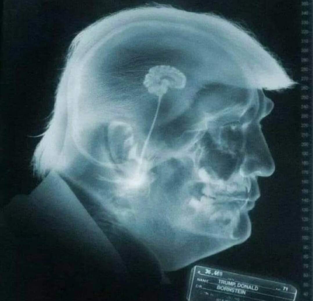DumortierEmily's tweet photo. Cette radiographie a fait ma journée ! https://t.co/jL2OfyTUvm