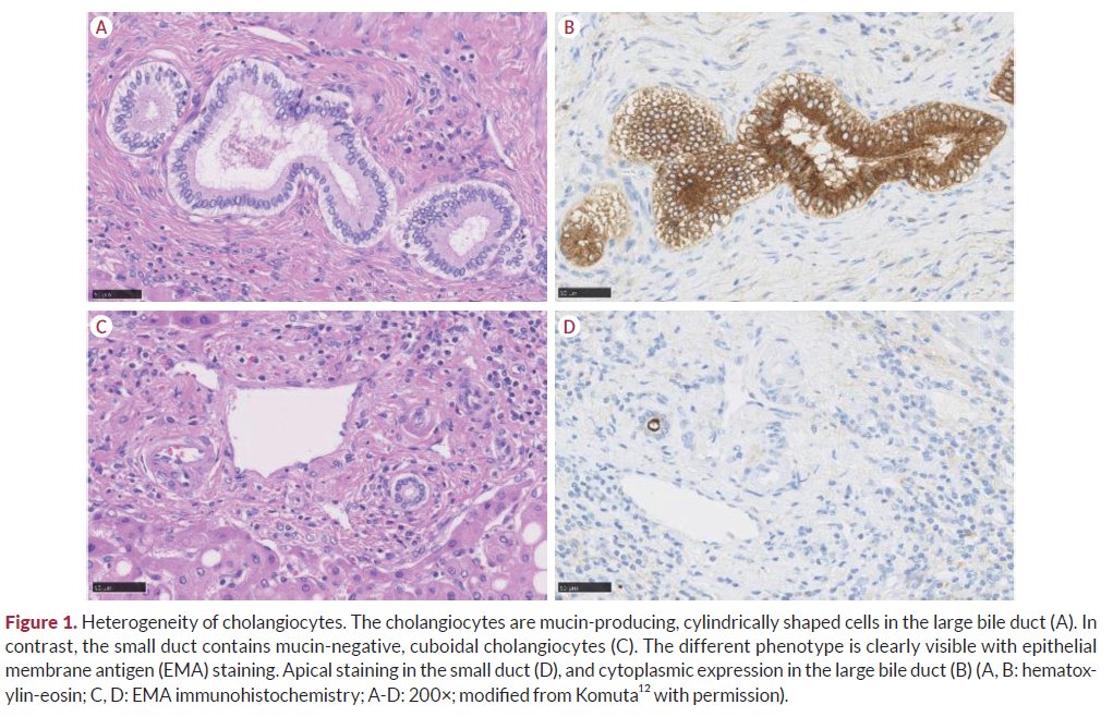 Intrahepatic cholangiocarcinoma: histological diversity and the role of the pathologist Review article by Dr. Mina Komuta Full text: doi.org/10.17998/jlc.2… #liverpath #pathtwitter