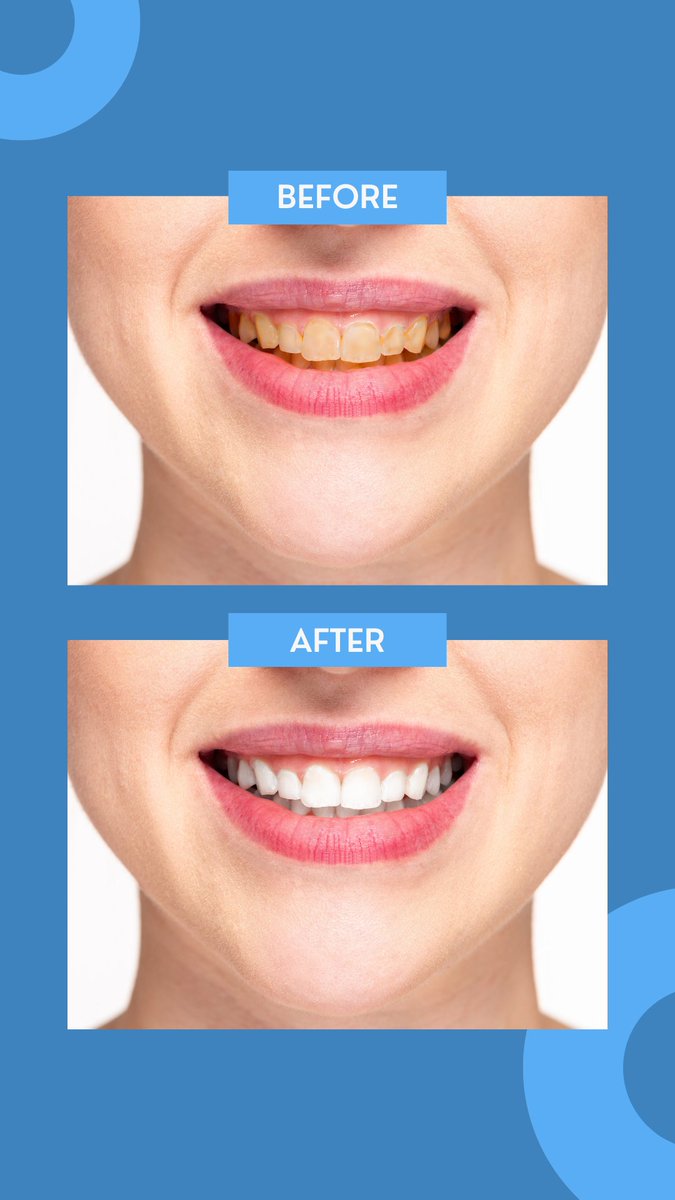 Fight Off Morning Breath: Dentist-Approved Tips for a Brighter, Fresher Start
Combat morning breath with these dentist-approved tips and greet the day with a brighter, fresher smile.
bit.ly/3V40o3Q

#dentalhealth #oralcare #healthyteeth #smilecare