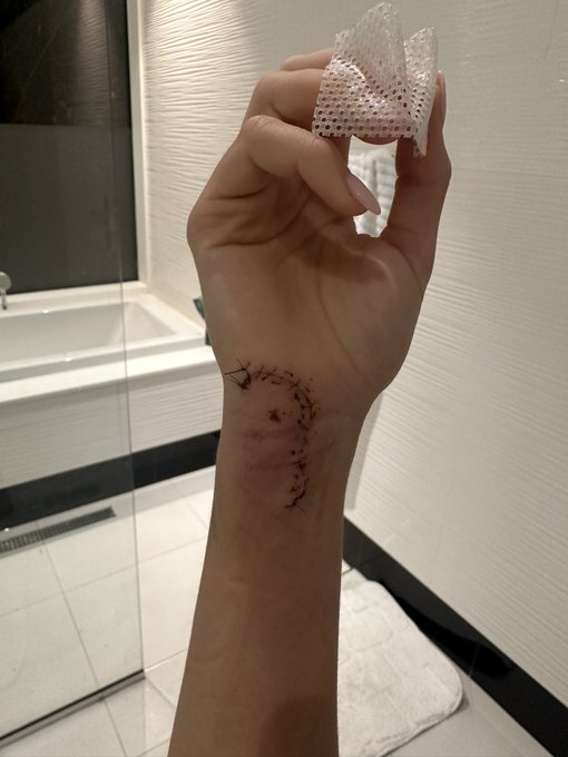 Vanessa - 0  Shower door - 1  Needed reconstructive surgery on this bad boy last week but I&rsquo;m lucky it<a href="/tag/binancecampus"class="tags"><span>#binancecampus</span></a>