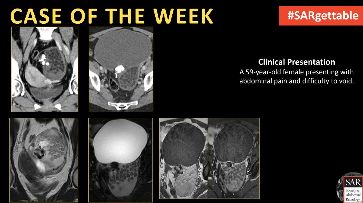 It's time for a new #SARgettable case of the week contributed by @AndreaEsqXR. Comment with your diagnosis down below!