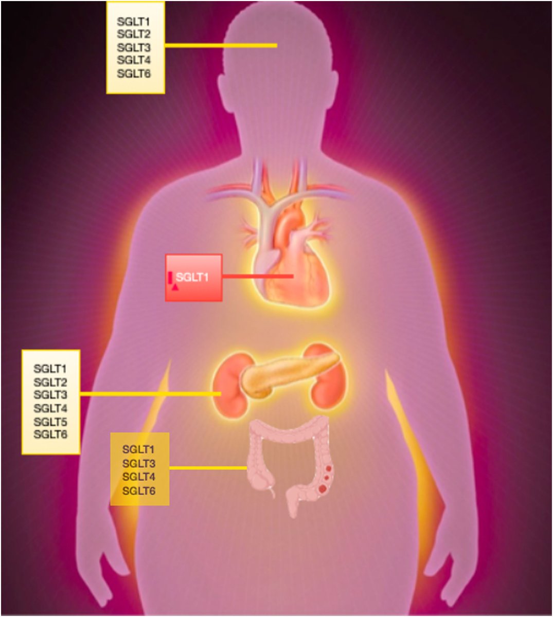 REC Publications (@revespcardiol) on Twitter photo Inhibición dual del SGLT1 y SGLT2: algo más que su suma #REC #AheadOfPrint  <a href="/kikes_sm/">E.S.M</a> <a href="/RequenaIbanez/">Juan Antonio Requena-Ibáñez, MD</a> <a href="/BadimonJuan/">Juan Badimon</a> revespcardiol.org//es-inhibicion… Inhibición dual del SGLT1 y SGLT2: algo más que su suma #REC #AheadOfPrint  <a href="/kikes_sm/">E.S.M</a> <a href="/RequenaIbanez/">Juan Antonio Requena-Ibáñez, MD</a> <a href="/BadimonJuan/">Juan Badimon</a> revespcardiol.org//es-inhibicion…