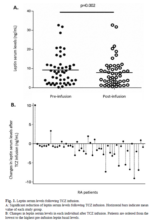 Anti-IL-6 therapy reduces leptin serum levels in patients with rheumatoid arthritis pubmed.ncbi.nlm.nih.gov/32452351/