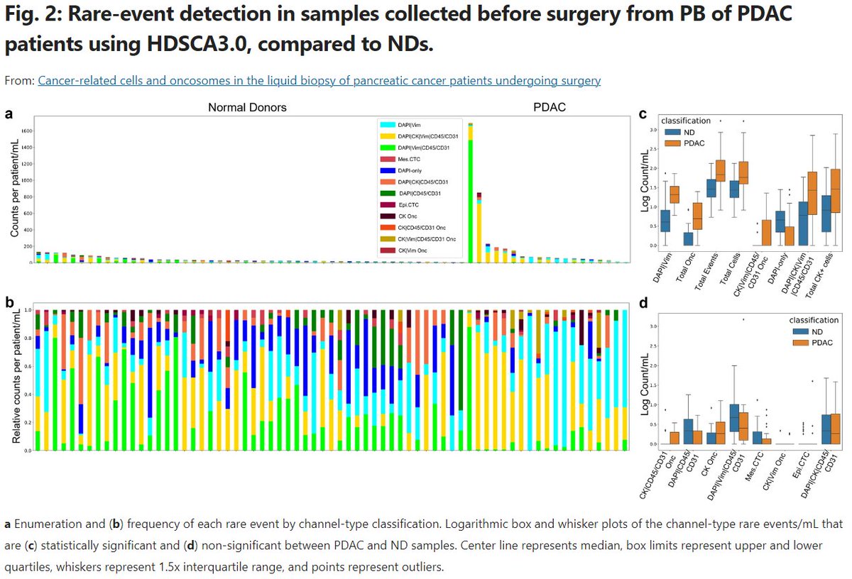 Jun Gong (@jgong15) on Twitter photo Highlighting seminal work from #KOL speakers at the 5th Annual <a href="/CSCancerCenter/">Cancer at Cedars-Sinai</a> GI Tumor Conf:
<a href="/DrNickNissen/">Nicholas Nissen</a>: Circulating cells/oncosomes in portal/periph blood for monitoring resectable #PDAC
pubmed.ncbi.nlm.nih.gov/38360856/
Mar 23, 2024. Register at cedars.cloud-cme.com/course/courseo…
<a href="/OncoAlert/">OncoAlert</a> Highlighting seminal work from #KOL speakers at the 5th Annual <a href="/CSCancerCenter/">Cancer at Cedars-Sinai</a> GI Tumor Conf:
<a href="/DrNickNissen/">Nicholas Nissen</a>: Circulating cells/oncosomes in portal/periph blood for monitoring resectable #PDAC
pubmed.ncbi.nlm.nih.gov/38360856/
Mar 23, 2024. Register at cedars.cloud-cme.com/course/courseo…
<a href="/OncoAlert/">OncoAlert</a>