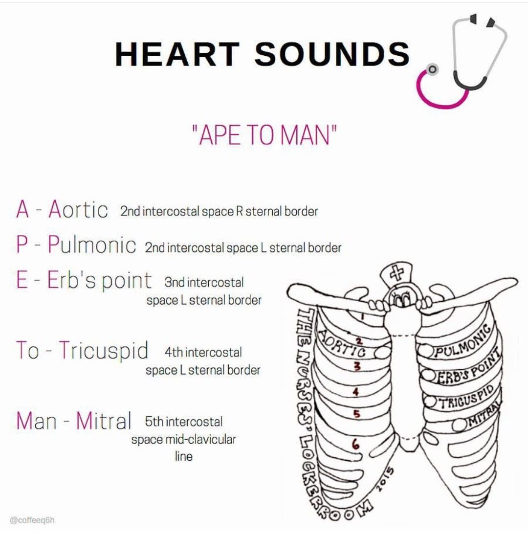 #MedTwitter #medX #MedEd #MBBS 
Heart sounds 
#heartsounds