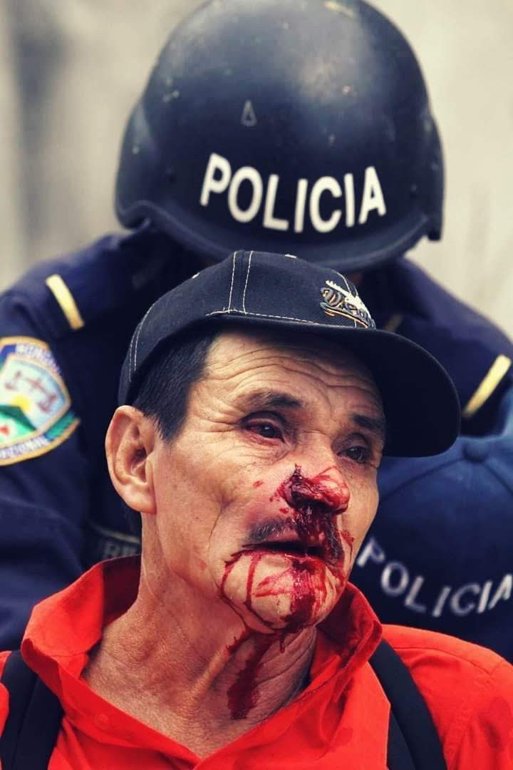 Nirvana_Pinto's tweet photo. 🔴 JUSTICIA PARA LAS VÍCTIMAS QUE FUERON ASESINADAS POR LA MANO  DE LA ESTRUCTURA CRIMINAL CACHURECA 🔴 https://t.co/HwWghJIUpw