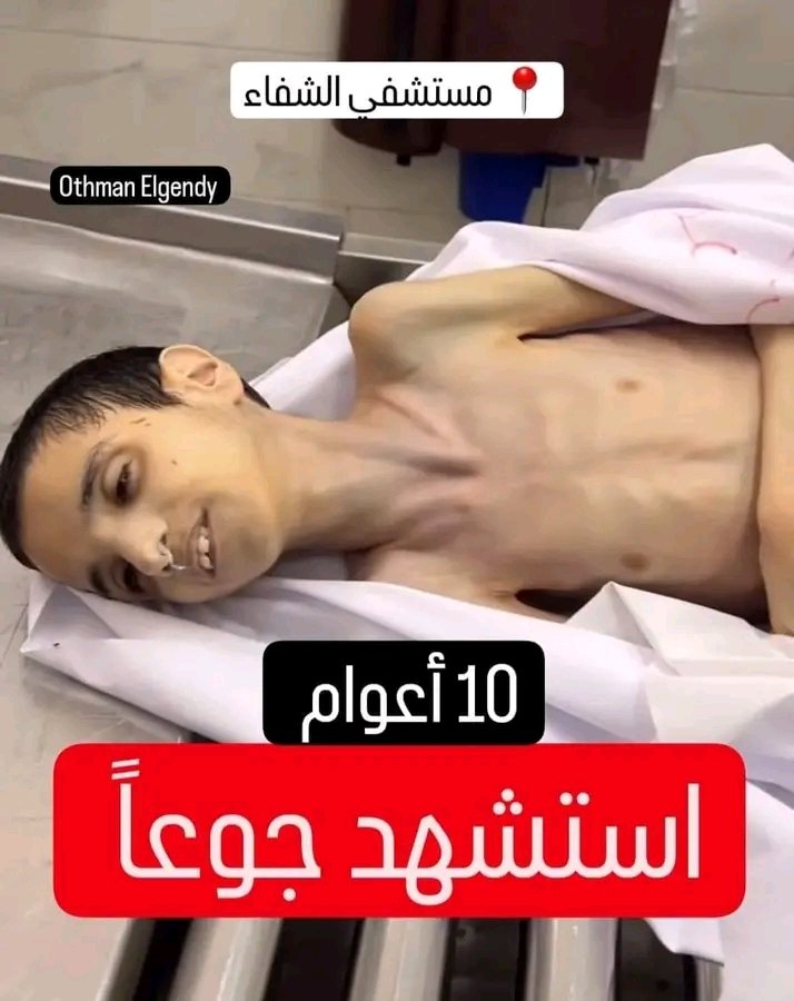 jbryl30's tweet photo. استشهد من الجوع ..!💔
اللهم إني أبرأ إليك من العرب وحكومات العرب وكل من تخاذل وطبّع مع قتلة الأطفال والنساء.
#ابو_عبيدة 💔🇵🇸💔 https://t.co/OYjOVTa7ew