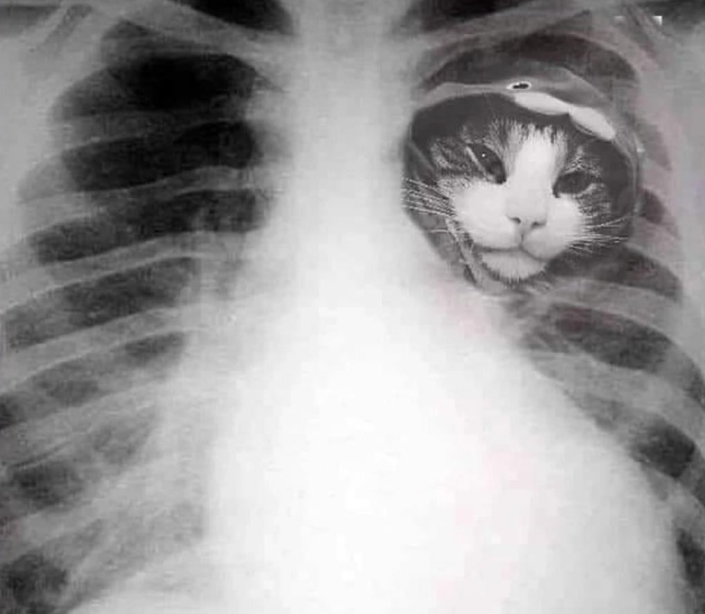 Got my x-rays back 🫶