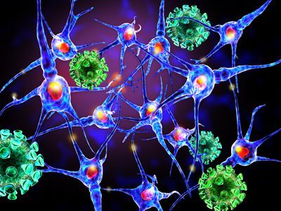 What happens when an autoimmune reaction causes nerve damage?
buff.ly/3yfwSf7 
#autoimmune  #autonomicneuropathy #bodyattckingitself  #bacterialinfections  #viralinfections