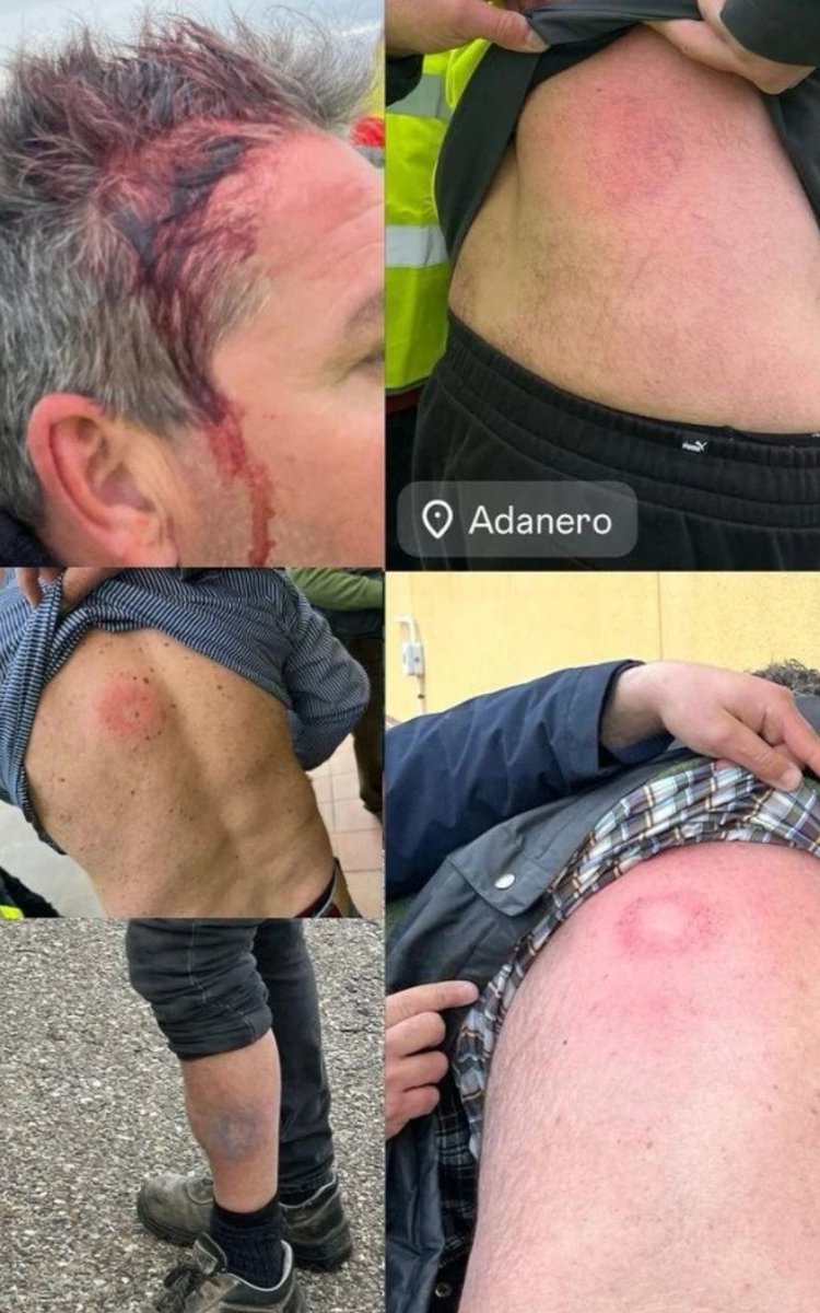mariodelser's tweet photo. "Sin ningún lesionado" No tenéis vergüenza. https://t.co/NnFNdxqj4u