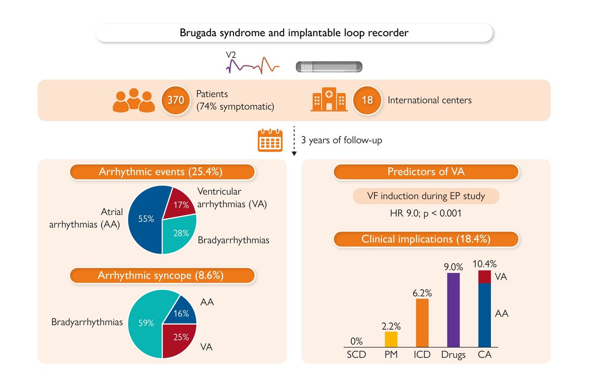 Implantable loop recorders in patients with Brugada syndrome: the BruLoop study. Read more in #EHJ: academic.oup.com/eurheartj/adva… #Brugada #looprecorder #rhythm #syncope #arrhythmia @escardio @ESC_Journals