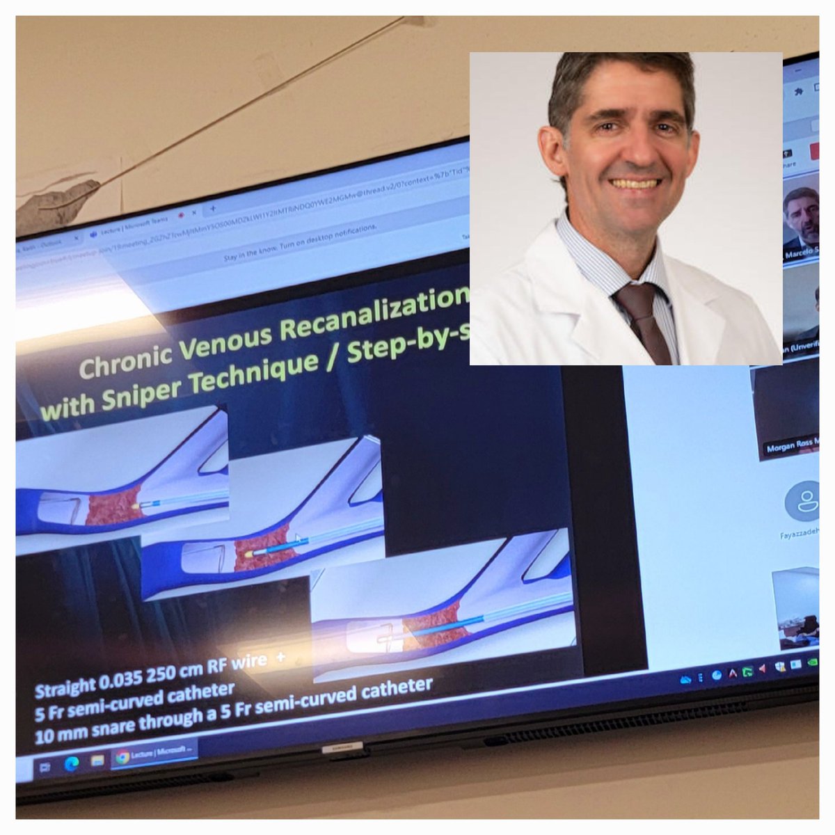 SLU Vascular Interventional Radiology (@slu_vir) on Twitter photo Thank you Dr Marcelo Guimaraes, #VIrad from <a href="/MUSCVIR/">MUSC Interventional</a> for an outstanding grand rounds for <a href="/SLU_VIR/">SLU Vascular Interventional Radiology</a> in Central Venous Recanalization using complex techniques! The step by step approach was super. Thank you Dr Marcelo Guimaraes, #VIrad from <a href="/MUSCVIR/">MUSC Interventional</a> for an outstanding grand rounds for <a href="/SLU_VIR/">SLU Vascular Interventional Radiology</a> in Central Venous Recanalization using complex techniques! The step by step approach was super.
