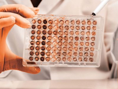 AmPharmRev's tweet image. Embracing the Future: How In Vitro Assays Are Transforming Nonclinical Toxicology

Read the article by Xiaoxia Li here - americanpharmaceuticalreview.com/Vitro-Assays-N…

#Toxicology #InVitroTesting #3RsPrinciple #EthicalScience #DrugDevelopment #AnimalWelfare #AlternativeMethods