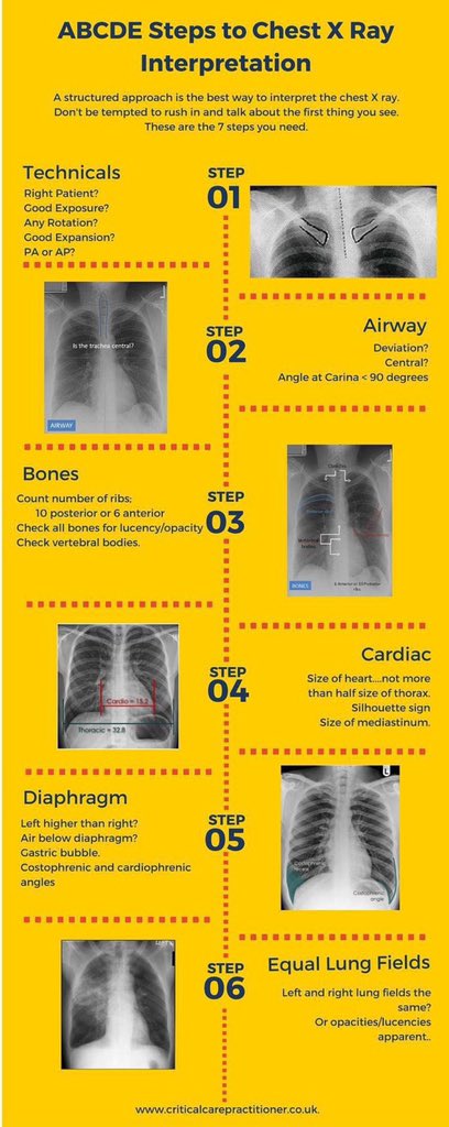 ABCDE steps to Chest X-RAY Interpretation

#pulmonary #pulmtwitter #pulmonology #respiratory #internalmedicine #TipsForNewDocs #MedEd #MedTwitter #medicine #medical #medicare #health #healthcare #FOAMed #ClinicalPearl #clinicaltips #MedStudents #xray #Radiology #MedX